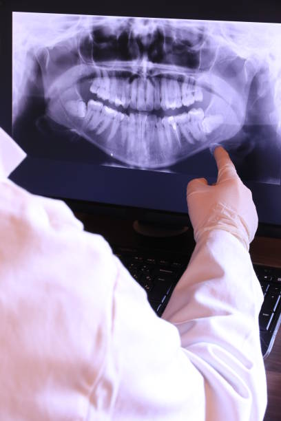 Best Emergency TMJ Treatment in Rancho Santa Fe, CA