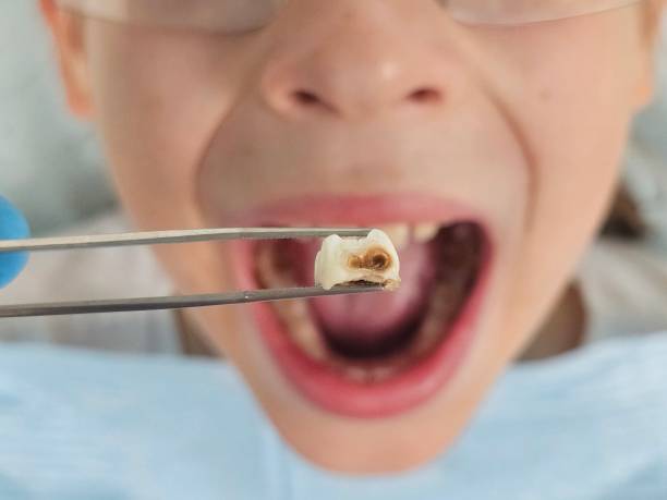 Best Pediatric Emergency Dentist in Rancho Santa Fe, CA